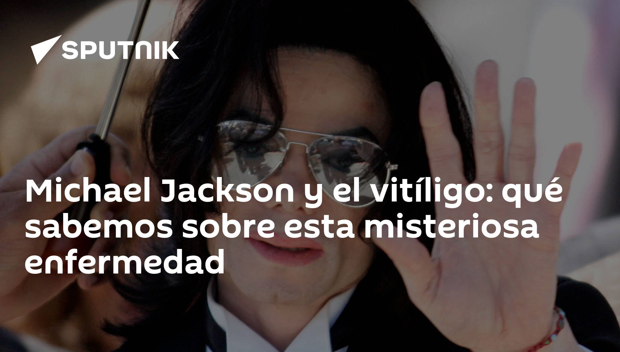Michael Jackson Y El Vitíligo Qué Sabemos Sobre Esta Misteriosa