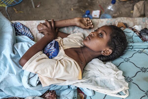 Девушка, пострадавшая в ходе боевых действий в Хумере, Эфиопия - Sputnik Mundo