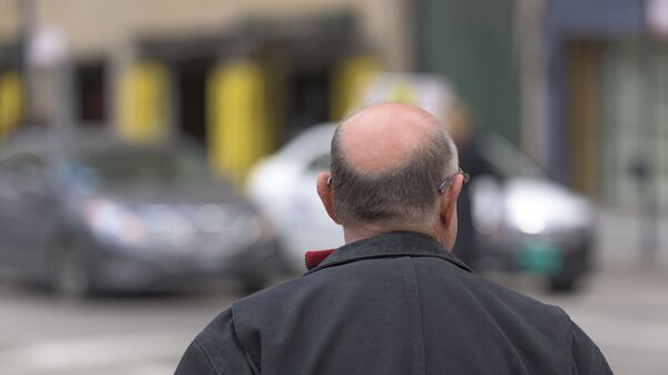 Un hombre con alopecia, imagen ilustrativa - Sputnik Mundo