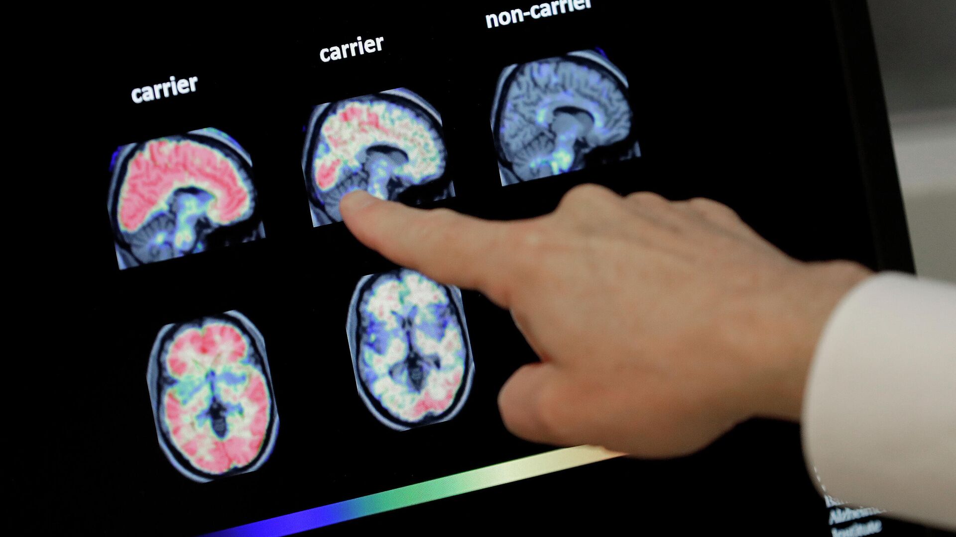 En esta foto de archivo del 14 de agosto de 2018, un médico observa una tomografía computarizada de un cerebro.  - Sputnik Mundo, 1920, 24.12.2021