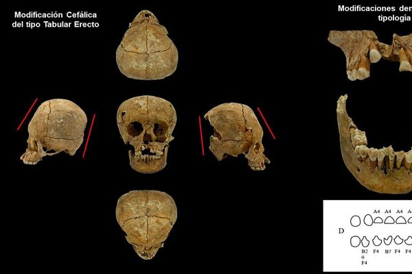 El cráneo de una mujer mexicana hace casi 14.000 años - Sputnik Mundo