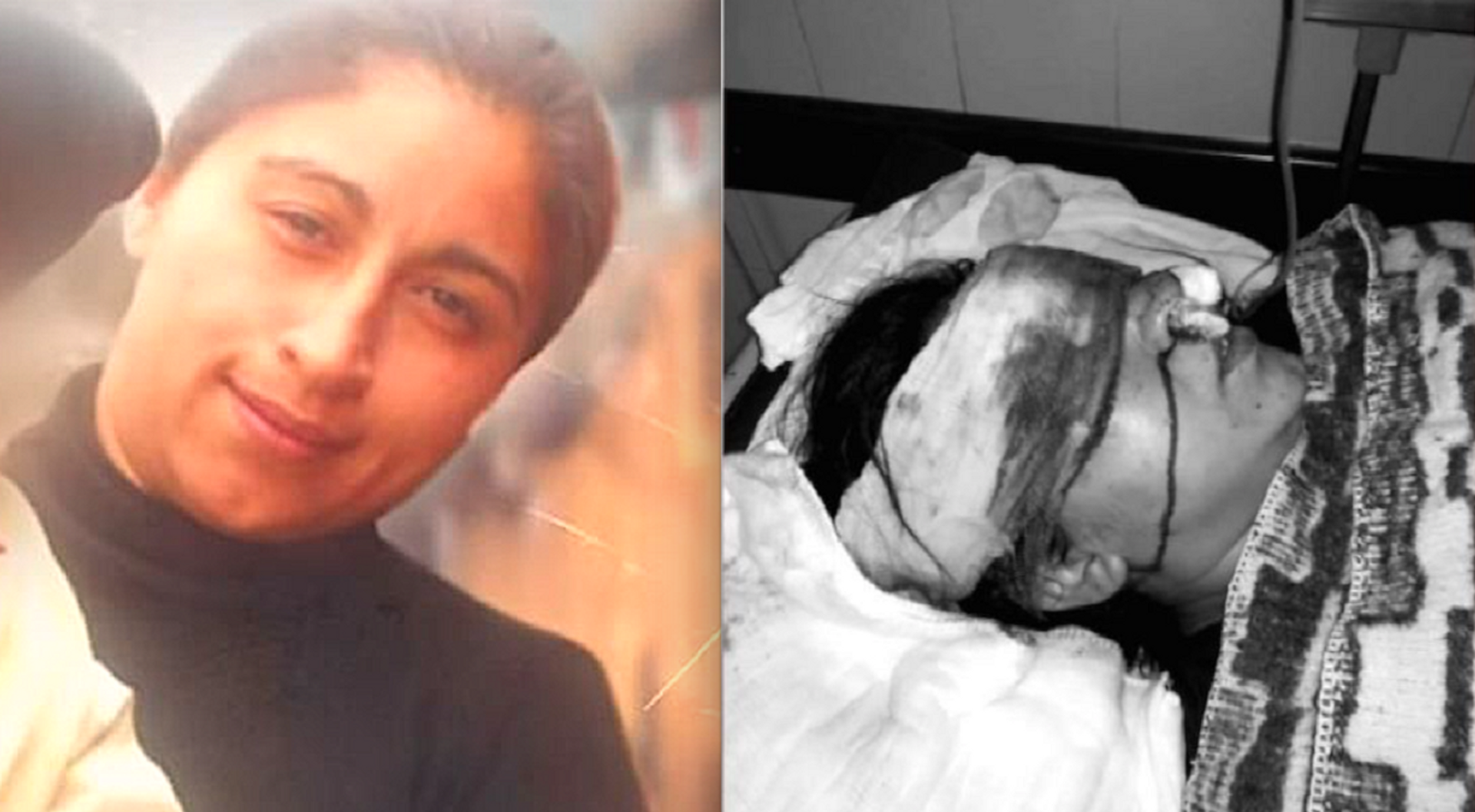 Fabiola Campillai Rojas, impactada en el rostro por una bomba lacrimógena arrojada por Carabineros - Sputnik Mundo, 1920, 14.06.2021