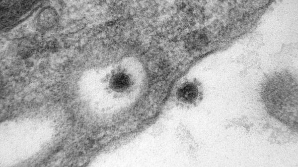 Imagen tomada con un microscopio de la cepa delta del SARS-CoV-2 - Sputnik Mundo