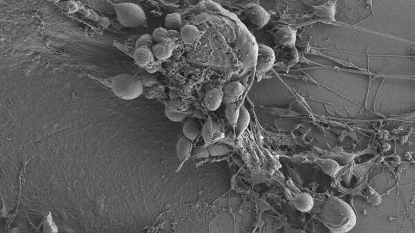 Célula de glioblastoma humano tratada con gosipol y vista con la técnica de microscopía electrónica de escaneo de emisión de campo, a partir de muestras obtenidas por fractura por congelación.  - Sputnik Mundo