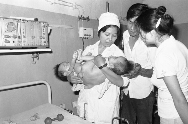 Dos siameses de un año de edad en el Hospital Viet Duc, en Hanói. Este centro se especializaba en el tratamiento de niños afectados por el Agente Naranja utilizado por el Ejército estadounidense durante la guerra. - Sputnik Mundo