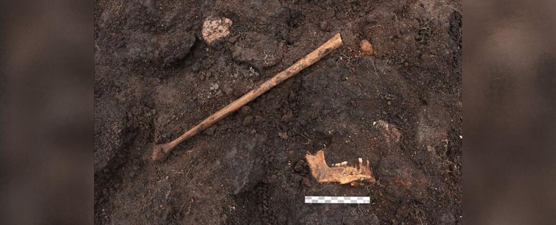 Huesos de una pierna humana, la pelvis y la mandíbula inferior de la momia del pantano - Sputnik Mundo, 1920, 25.12.2022