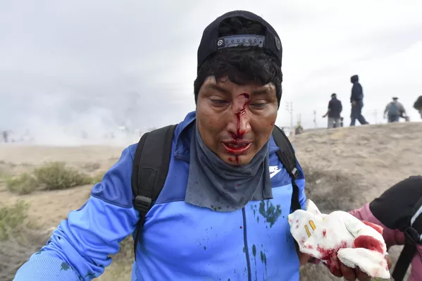 Castillo fue declarado en impeachmeant después de tomar la decisión de disolver el Congreso y declarar estado de emergencia. Despojado de su cargo, el exmandatario fue arrestado y acusado de intento de golpe de Estado.  En la foto: un participante de las manifestaciones en Arequipa contra el nuevo Gobierno resultó herido durante un enfrentamiento con la policía. - Sputnik Mundo