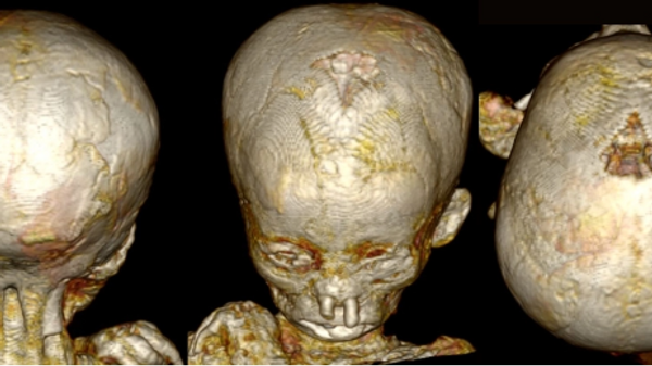 Reconstrucción 3D del cráneo de uno de los niños - Sputnik Mundo