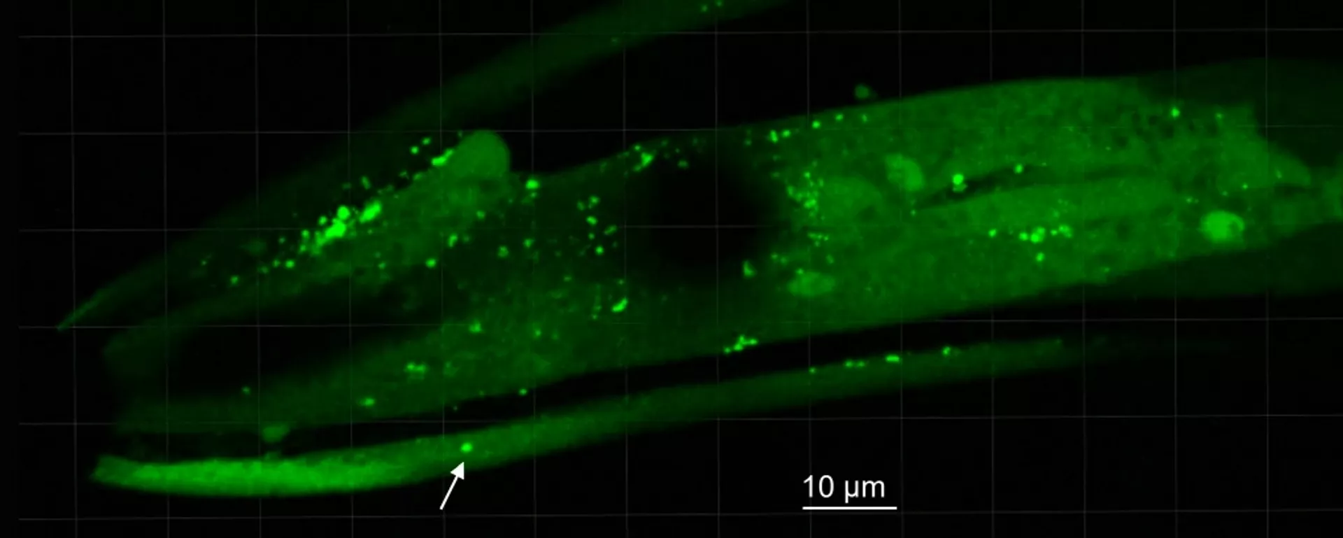 Los puntos brillantes indican la presencia de grumos de alfa-sinucleína en el interior de las cabezas de gusanos alimentados con bacterias Desulfovibrio - Sputnik Mundo, 1920, 08.05.2023