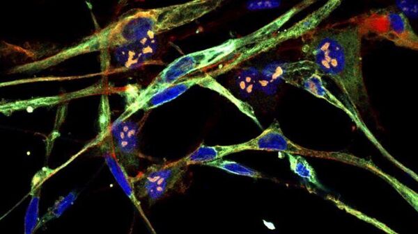 Células de rabdomiosarcoma que se transformaron en células musculares. - Sputnik Mundo