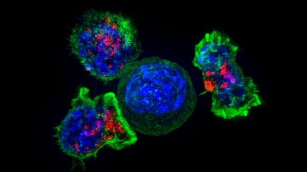Células T (verde y rojo) rodeando una célula cancerosa (azul, centro) - Sputnik Mundo
