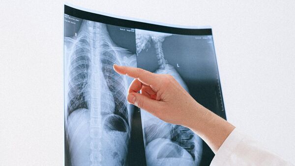Un médico sujetando una radiografía (imagen de referencia) - Sputnik Mundo
