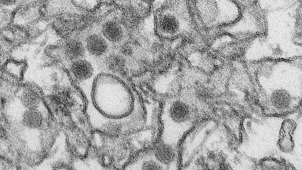 Virus de Zika bajo un microscopio - Sputnik Mundo