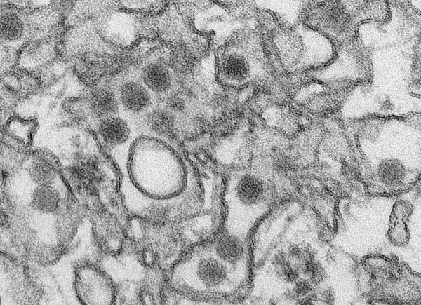 Virus Zika: una nueva amenaza de pandemia - Sputnik Mundo