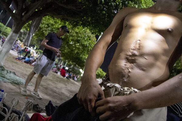 Ex-militar salvadoreño muestra las operaciones en su abdomen, tras un atentado con armas de fuego en su país, Huehuetán, Chiapas, México Ex-militar salvadoreño muestra las operaciones en su abdomen, tras un atentado con armas de fuego en su país, Huehuetán, Chiapas, México - Sputnik Mundo