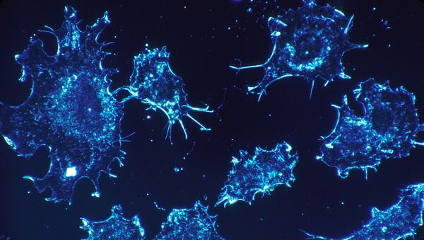 Las células cancerosas en una imagen  - Sputnik Mundo