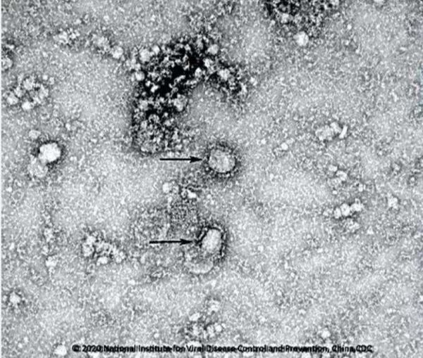 China publica la primera imagen del coronavirus China publica la primera imagen del coronavirus - Sputnik Mundo