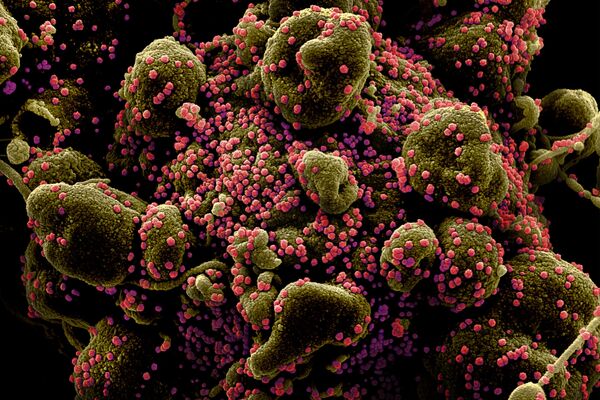 Micrografía electrónica coloreada de una célula humana (marrón verdoso) infectada por el virus SARS-COV-2 (rosa) - Sputnik Mundo