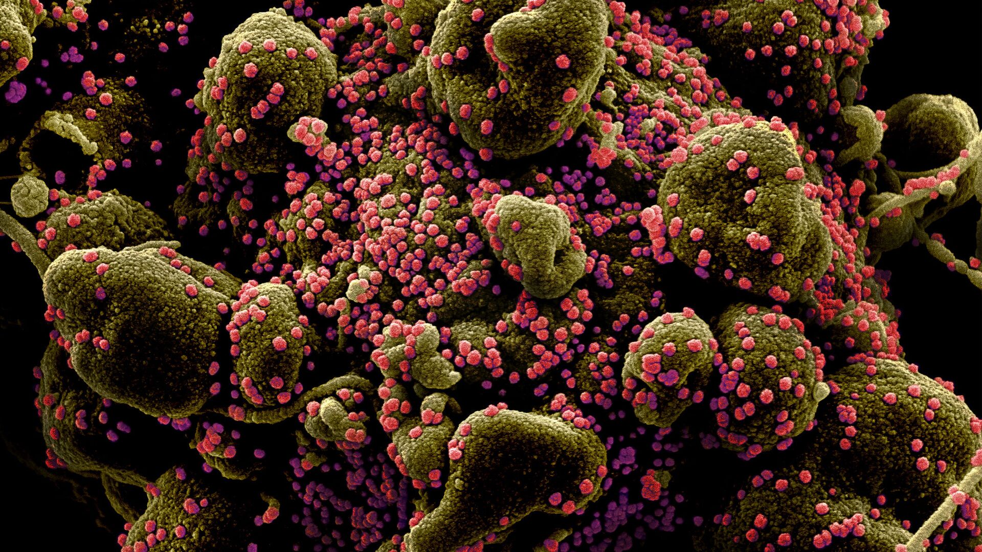 Micrografía electrónica coloreada de una célula humana (marrón verdoso) infectada por el virus SARS-COV-2 (rosa) - Sputnik Mundo, 1920, 30.11.2021