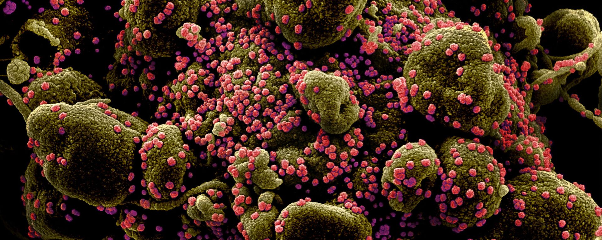 Micrografía electrónica coloreada de una célula humana (marrón verdoso) infectada por el virus SARS-COV-2 (rosa) - Sputnik Mundo, 1920, 11.08.2021