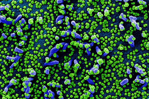 Micrografía electrónica coloreada de una célula humana (azul) infectada por el virus SARS-COV-2 (verde) - Sputnik Mundo