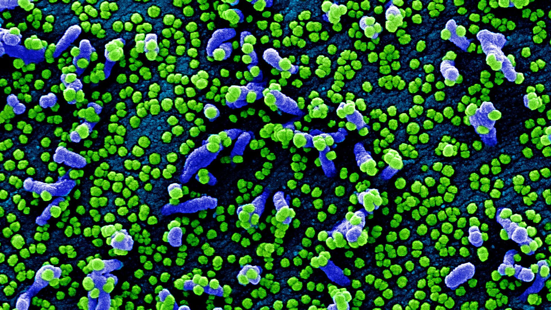 Micrografía electrónica coloreada de una célula humana (azul) infectada por el virus SARS-COV-2 (verde) - Sputnik Mundo, 1920, 30.08.2021