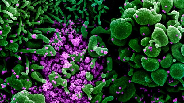 Micrografía electrónica coloreada de una célula humana (verde) infectada por el virus SARS-COV-2 (violeta) - Sputnik Mundo
