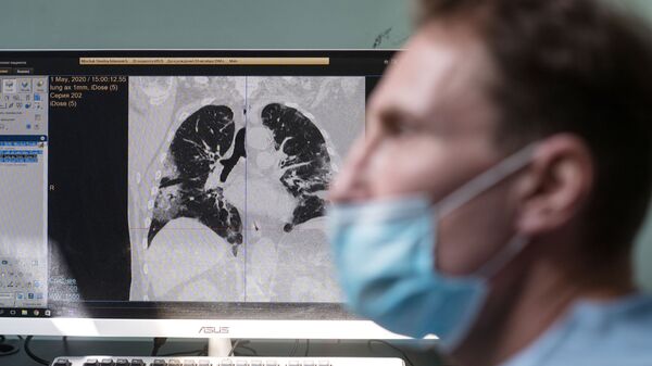 Imagen de pulmones con neumonia - Sputnik Mundo