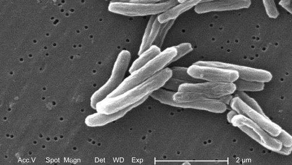 Organización Mundial de la Salud  reporta 1.700.000 muertos por la tuberculosis en 2009 - Sputnik Mundo