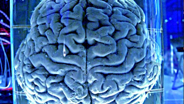 Cerebro humano autosuficiente para calmar el dolor, dicen los científicos - Sputnik Mundo